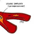 Oggi parliamo di... PLACCA ATEROSCLEROTICA